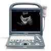 Portable Color Doppler