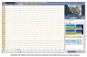 EASY III EEG FOR CRITICAL CARE