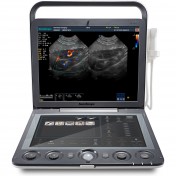 S9V Feel The Difference